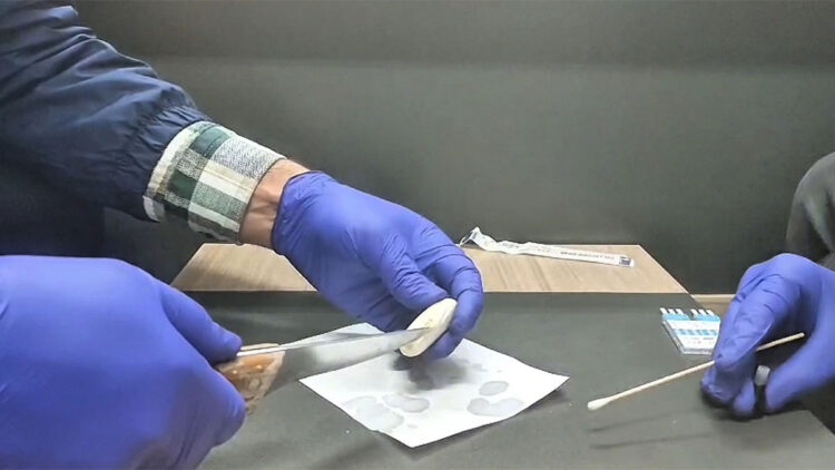 İranlı şüphelinin mide ve bağırsağından uyuşturucu çıktı