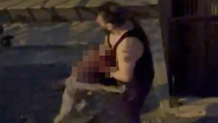 Bahçelievler'de Pitbull dehşeti; Sahibine saldırdı