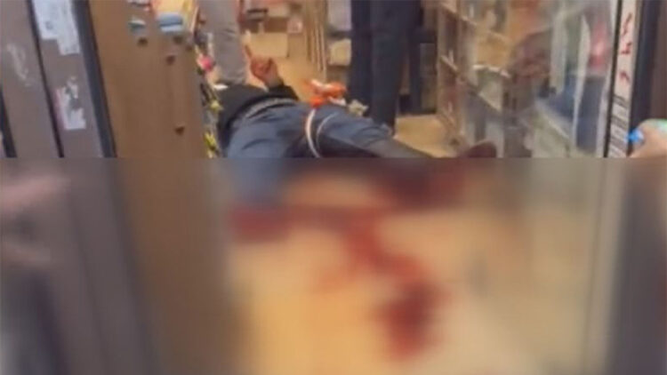 Sultangazi'de yaşları küçük iki grup arasında bıçaklı kavga: 3 yaralı