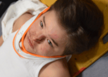 Kazada yaralanan anne ve oğlunu taşıyan ambulans, otomobille çarpıştı