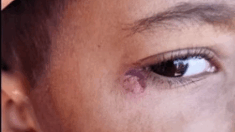 Öğrencinin yüzünde sigara söndüren temizlikçi tutuklandı