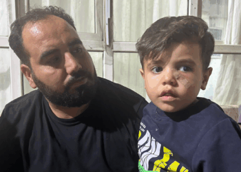 Yorgun mermi, 4 yaşındaki çocuğun gözünün altına isabet etti