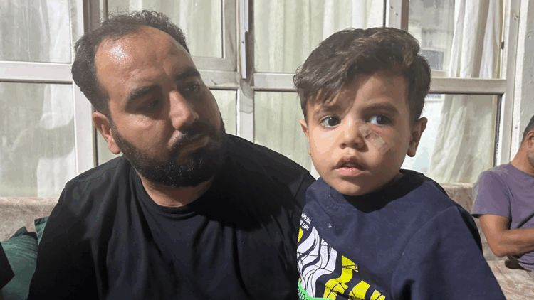 Yorgun mermi, 4 yaşındaki çocuğun gözünün altına isabet etti