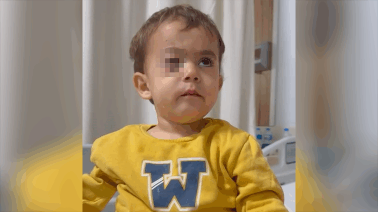 2 yaşındaki Alpaslan'ı kör eden torpil, fırından alınmış