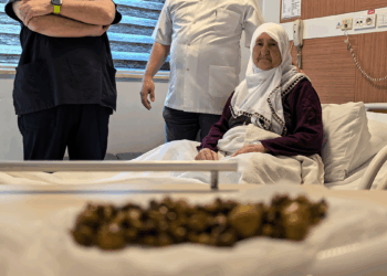 Bursa'da 77 yaşındaki kadının safra kesesinden 213 tane taş çıkarıldı