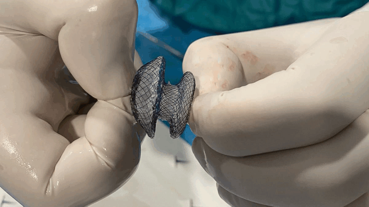 Kalpte delik rahatsızlığı kapalı yöntemle tedavi edilebiliyor