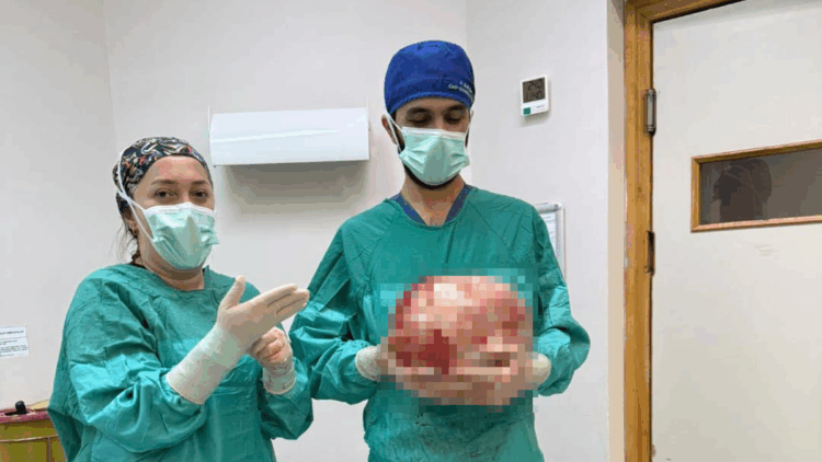 Karnından 8 buçuk kiloluk kitle çıkarıldı