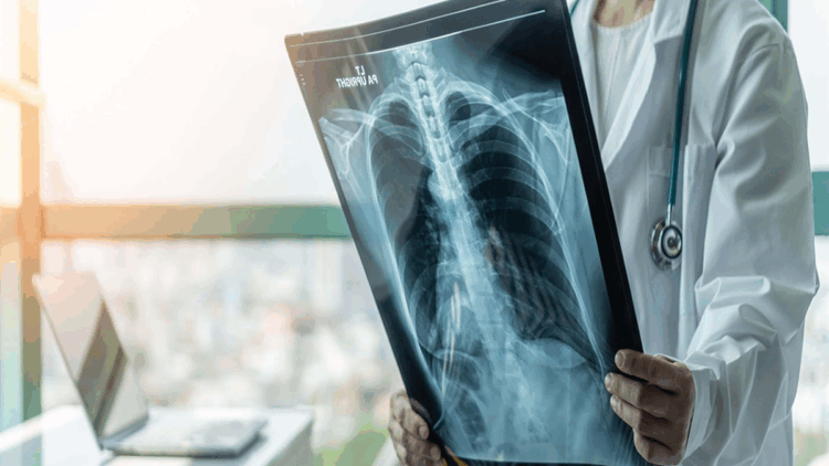 Prof. Dr. Şener'den 'süperenfeksiyon' uyarısı: Dikkat etmek lazım