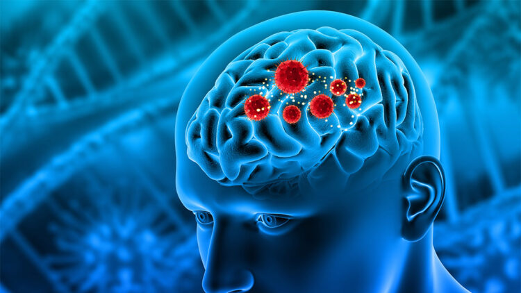 Her beyin tümörü kötü huylu değildir