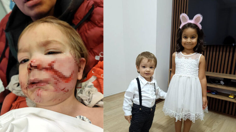 Ankara'da 2 kardeşe saldıran pitbull ve sahibi yakalandı