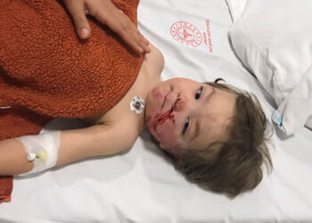 Ankara'da pitbull saldırısına uğrayan 1,5 ve 5 yaşındaki kardeşler yaralanarak hastaneye kaldırıldı.