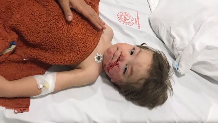Ankara'da pitbull saldırısına uğrayan 1,5 ve 5 yaşındaki kardeşler yaralanarak hastaneye kaldırıldı.