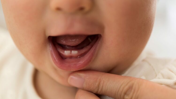 Yeni doğan bebekte diş varsa ve sallanıyorsa acil müdahale gerekebilir
