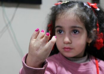 10 ameliyat geçiren yapışık parmak Elif Lina’nın ailesinden çağrı