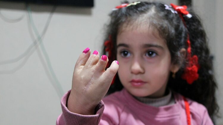 10 ameliyat geçiren yapışık parmak Elif Lina’nın ailesinden çağrı