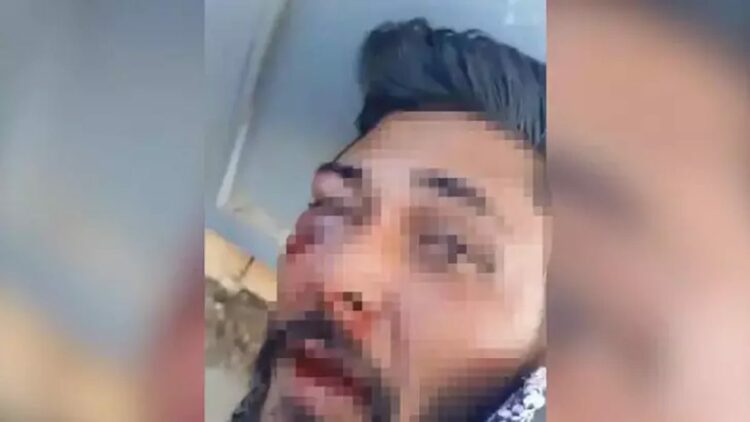 16 yaşındaki kız çocuğunu taciz şüphelisine meydan dayağı