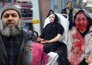 Boşanma aşamasındaki eşini kaldırım taşıyla dövdü