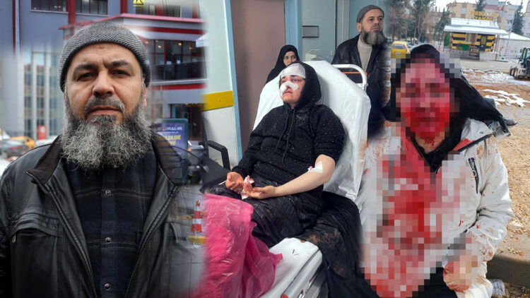 Boşanma aşamasındaki eşini kaldırım taşıyla dövdü