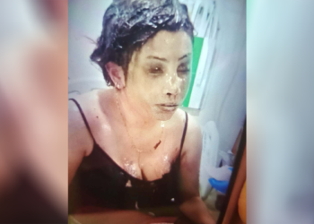 Boşanma aşamasındaki eşinin başından aşağı kezzap döktü