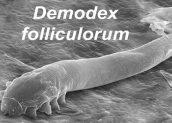 Gözde yanma, sulanma ve kaşıntı varsa demodex parazitine dikkat !