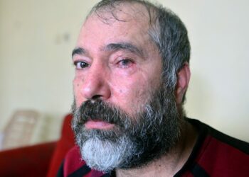 Durakta küfür tartışmasında bardakla vurulan gözünü kaybetti