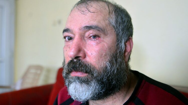 Durakta küfür tartışmasında bardakla vurulan gözünü kaybetti