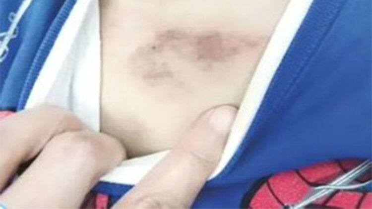 Eyüpsultan'da 3 yaşındaki çocuğa şiddet iddiası