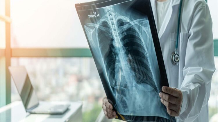 Kışın solunum yolu enfeksiyonlarında artış doğal, hijyen şart