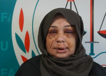 Polis eşi tarafından darbedildiği iddiasıyla şikayetçi oldu