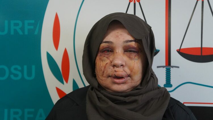 Polis eşi tarafından darbedildiği iddiasıyla şikayetçi oldu