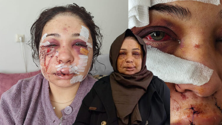 Fatma Çakmak'a işkence eden Cumhurbaşkanlığı koruma polisi tutuklandı