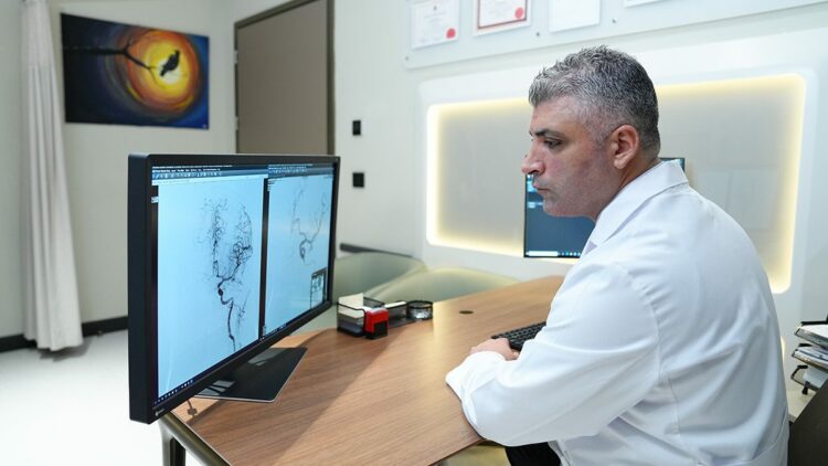 Beyin anevrizması her 20 kişiden birinde görülebilir