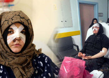 Eşinin kaldırım taşı ile dövdüğü Nazlı'nın sağ gözünde görme kaybı, kafasında kırık var