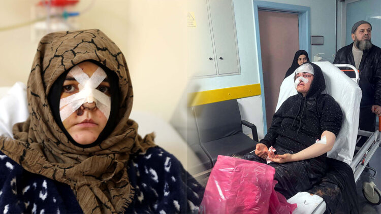 Eşinin kaldırım taşı ile dövdüğü Nazlı'nın sağ gözünde görme kaybı, kafasında kırık var