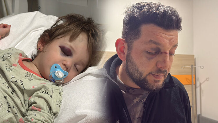 Komşu terörü! Gürültü tartışmasında 14 aylık bebeğin kafatası çatladı