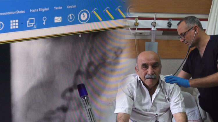 Hastanın kalbine giden kanı akciğere yönlendiren ‘anormal damar‘ operasyonla kapatıldı