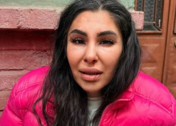 İlişkisini bitirmek istedi darbedilip burnu kırıldı: Yaşamak istiyorum