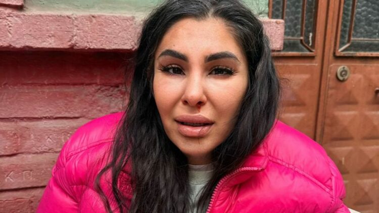 İlişkisini bitirmek istedi darbedilip burnu kırıldı: Yaşamak istiyorum 