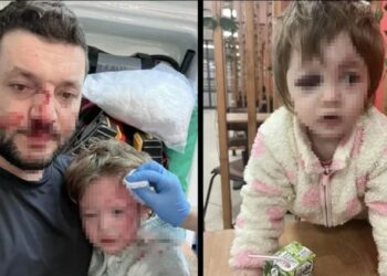 Yalova'da baba ve 14 aylık bebeğinin darbedildiği olayla ilgili müfettişler görevlendirildi