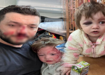 Kucağında bebeği ile darbedilen babanın oğlu, sokakta başına atılan taşla yaralandı
