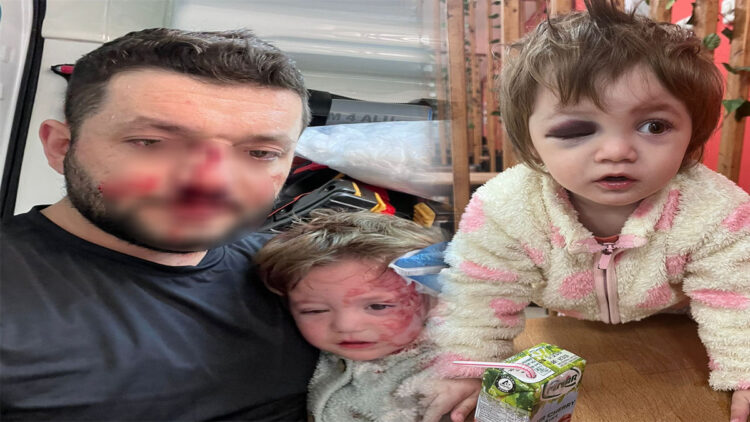 Kucağında bebeği ile darbedilen babanın oğlu, sokakta başına atılan taşla yaralandı