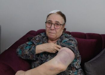 Esenyurt'ta bir yıldır tehdit ettiği çifti sopayla darbetti