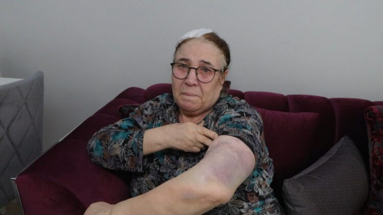 Esenyurt'ta bir yıldır tehdit ettiği çifti sopayla darbetti