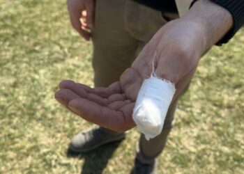 Parkta köpeği Şans ile gezerken başıboş pitbullun saldırısına uğradı