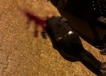 Sokakta yürürken tabanca ile başından vuruldu