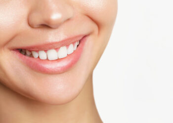 Hollywood gülüşü nedir? Nasıl yapılır?