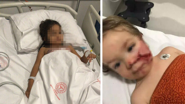 Ankara'da 2 kardeşi yaralayan pitbullun sahibinin annesi hakkında suç duyurusu kararı