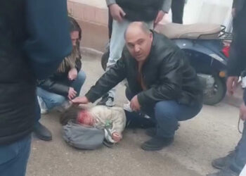 Devrilen motosikletteki kardeşler yaralandı; ağlayan çocuğu çevredekiler sakinleştirdi