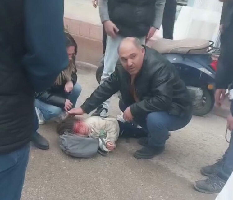 Devrilen motosikletteki kardeşler yaralandı; ağlayan çocuğu çevredekiler sakinleştirdi