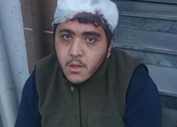 Sultangazi'de zihinsel engelli ve annesine sopalı saldırı